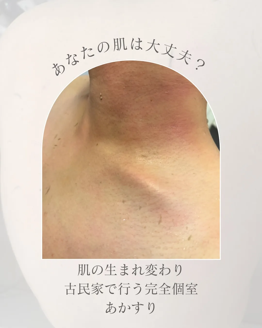 赤すりって本当に必要？ 