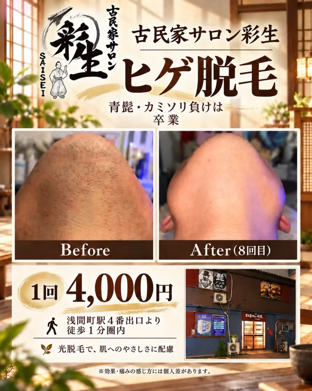 青髭・カミソリ負けが気になる方へ|名古屋市西区の浅間町 メン...