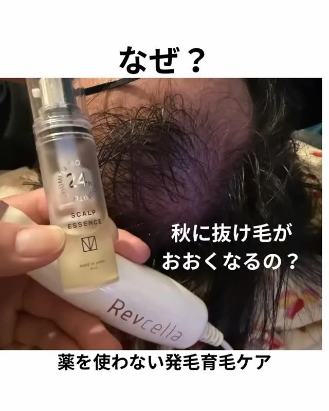 秋の抜け毛・薄毛対策にお悩みの方へ